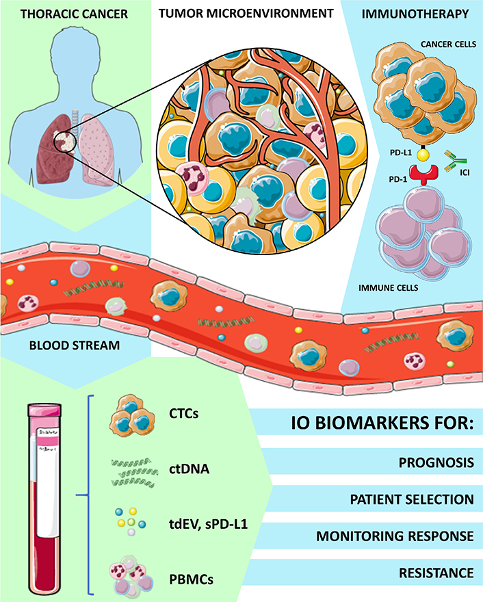 biphasic type malignant mesothelioma