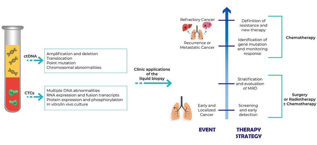 can radiation therapy cause mesothelioma