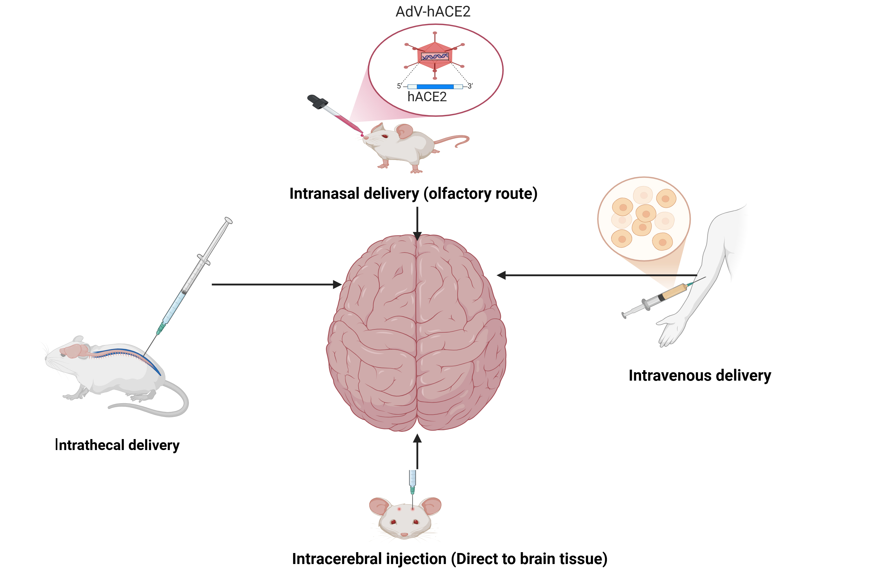 Neuron Spray Exploration of Neuroprotective Therapy
