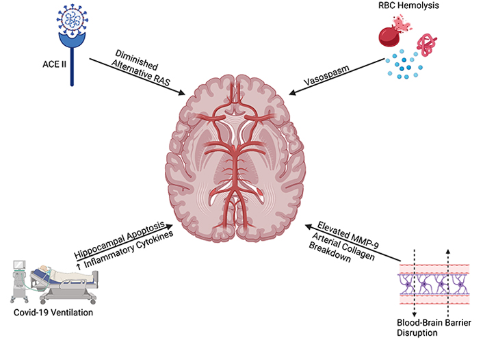 Subarachnoid Hemorrhage Symptoms & Treatment