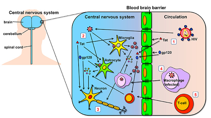 Neurological complications during HIV infection