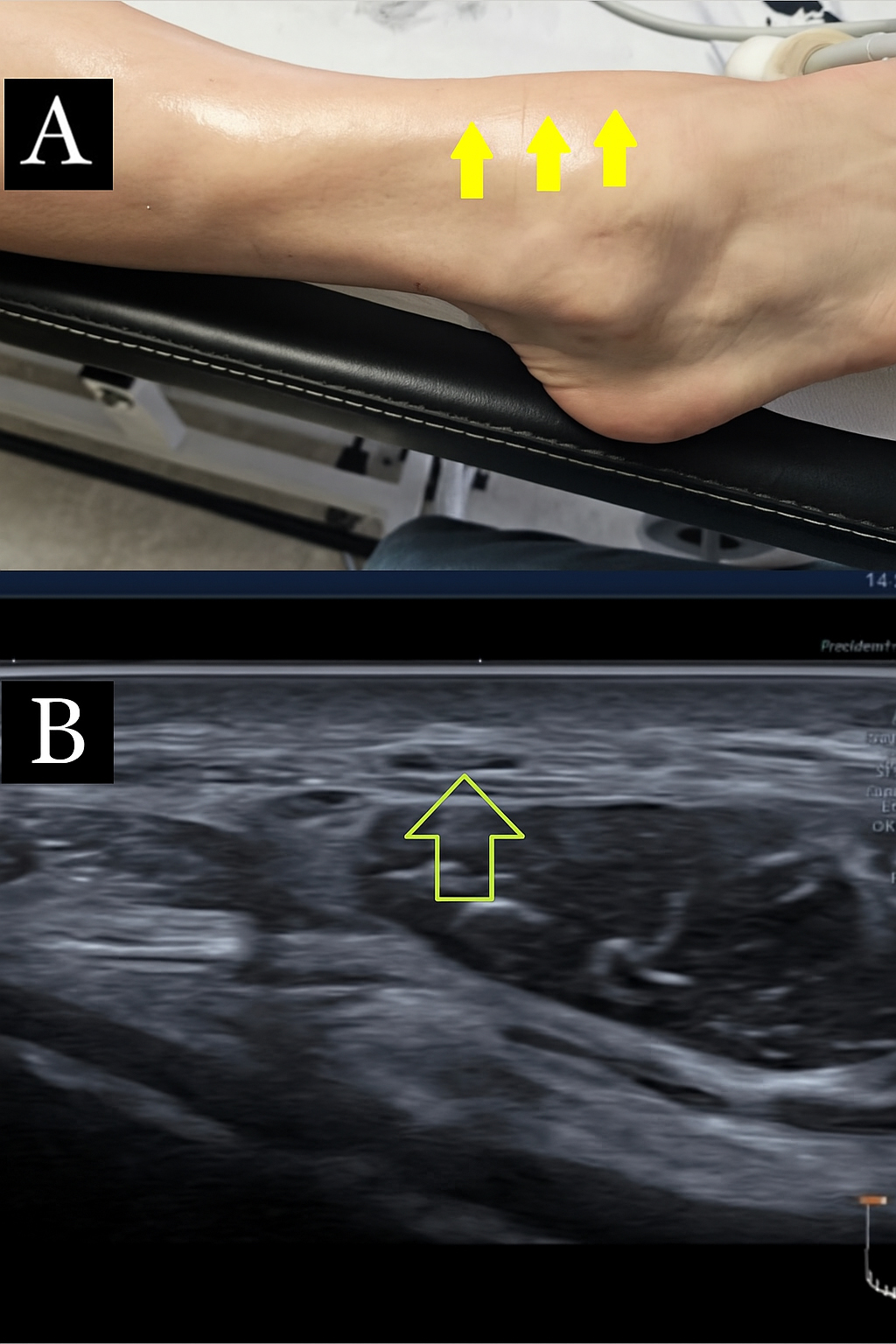Exploration of Musculoskeletal Diseases